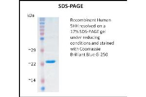 SDS-PAGE (SDS) image for Sonic Hedgehog (SHH) (Active) protein (ABIN5509475) (Sonic Hedgehog Protein (SHH))