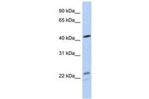 Image no. 1 for anti-Branched Chain Keto Acid Dehydrogenase E1, alpha Polypeptide (BCKDHA) (AA 71-120) antibody (ABIN6743978) (BCKDHA 抗体  (AA 71-120))