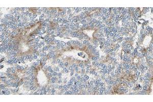 ABIN6275363 at 1/100 staining Human prostate tissue by IHC-P.