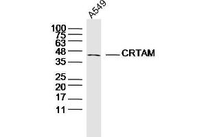 Human A549 cells probed with CRTAM Polyclonal Antibody, unconjugated  at 1:300 overnight at 4°C followed by a conjugated secondary antibody at 1:10000 for 90 minutes at 37°C. (CRTAM 抗体  (AA 31-130))