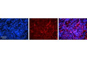 Rabbit Anti-IRF3 Antibody   Formalin Fixed Paraffin Embedded Tissue: Human Lymph Node Tissue Observed Staining: Cytoplasm Primary Antibody Concentration: 1:100 Other Working Concentrations: 1:600 Secondary Antibody: Donkey anti-Rabbit-Cy3 Secondary Antibody Concentration: 1:200 Magnification: 20X Exposure Time: 0. (IRF3 抗体  (C-Term))