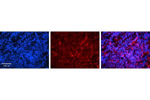 Rabbit Anti-IRF3 Antibody   Formalin Fixed Paraffin Embedded Tissue: Human Lymph Node Tissue Observed Staining: Cytoplasm Primary Antibody Concentration: 1:100 Other Working Concentrations: 1:600 Secondary Antibody: Donkey anti-Rabbit-Cy3 Secondary Antibody Concentration: 1:200 Magnification: 20X Exposure Time: 0. (IRF3 抗体  (C-Term))