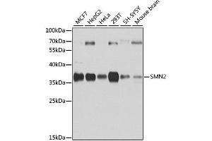 Western blot analysis of extracts of various cell lines, using SMN2 antibody. (SMN2 抗体)