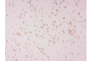 Formalin-fixed and paraffin embedded rat brain labeled with Anti-LATS2 (Ser83) Polyclonal Antibody, Unconjugated  at 1:300 followed by conjugation to the secondary antibody and DAB staining. (LATS2 抗体  (pSer83))