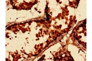Immunohistochemistry analysis of human testis tissue using ABIN7143089 at dilution of 1:100 (ARPC3 抗体  (AA 2-175))