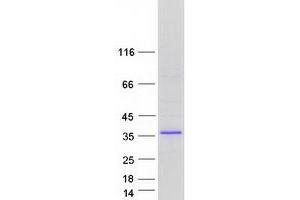 Western Blotting (WB) image for Four and A Half LIM Domains 1 (FHL1) (Transcript Variant 5) protein (Myc-DYKDDDDK Tag) (ABIN2721135)