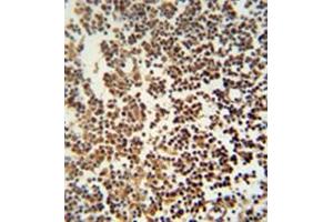 Immunohistochemistry analysis in formalin fixed and paraffin embedded human lymph tissue reacted with GTSF1 Antibody (Center) Cat. (GTSF1 抗体  (Middle Region))