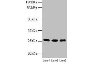 Western blot All lanes: LIN7A antibody at 6 μg/mL Lane 1: Human placenta tissue Lane 2: Mouse kidney tissue Lane 3: Mouse liver tissue Secondary Goat polyclonal to rabbit IgG at 1/10000 dilution Predicted band size: 26 kDa Observed band size: 26 kDa (LIN7A 抗体  (AA 1-233))