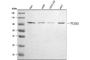 Western blot analysis of VCAM1 using anti-VCAM1 antibody (ABIN7600921).