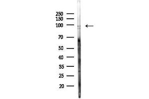 Western blot analysis of lysates from  cells(heat-shock,45 min treatment), using PYGB Antibody at 1/1000 dilution.