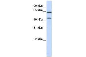CHGN antibody used at 1 ug/ml to detect target protein. (CSGALNACT1 抗体  (C-Term))