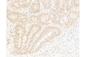 Immunohistochemistry (IHC) image for anti-K(lysine) Acetyltransferase 8 (KAT8) (AA 1-50) antibody (ABIN7454709) (MYST1 抗体  (AA 1-50))