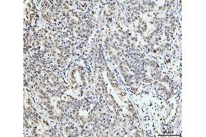 IHC analysis of 53BP1/TP53BP1 using anti-53BP1/TP53BP1 antibody (ABIN7599869).