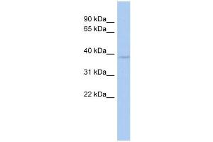 WB Suggested Anti-WBP2NL Antibody Titration: 0. (WBP2NL 抗体  (Middle Region))