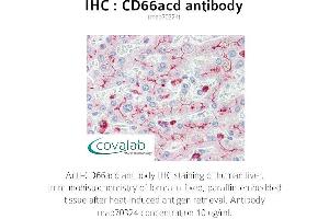Image no. 1 for anti-Carcinoembryonic Antigen-Related Cell Adhesion Molecule 1/3/6 (CEACAM1/3/6) antibody (ABIN1723246) (CD66acd 抗体)