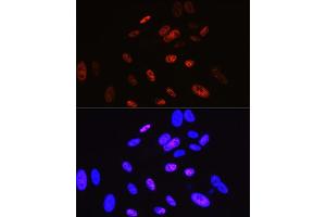 Immunofluorescence analysis of U-2 OS cells using Cyclin H Rabbit mAb (ABIN7266569) at dilution of 1:100 (40x lens). (Cyclin H 抗体)