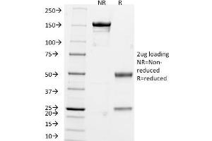 SDS-PAGE Analysis of Purified Chromogranin A Monoclonal Antibody (CHGA/765). (Chromogranin A 抗体)