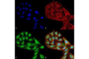 Immunocytochemistry/Immunofluorescence analysis using Rabbit Anti-WIPI2 Polyclonal Antibody . (WIPI2 抗体  (C-Term) (Atto 594))