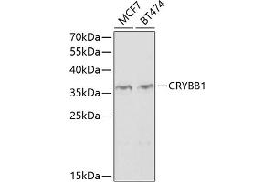 Western blot analysis of extracts of various cell lines, using CRYBB1 antibody  at 1:1000 dilution. (CRYBB1 抗体  (AA 1-252))