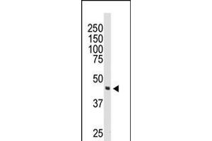 Western blot analysis of anti-DOK2 Pab in 174xCEM cell lysate (DOK2 抗体  (C-Term))