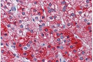 Human Adrenal: Formalin-Fixed, Paraffin-Embedded (FFPE) (SH3BP5 抗体  (AA 4-113))
