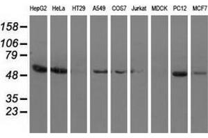 Western blot analysis of extracts (35 µg) from 9 different cell lines by using anti-SNTA1 monoclonal antibody. (SNTA1 抗体)