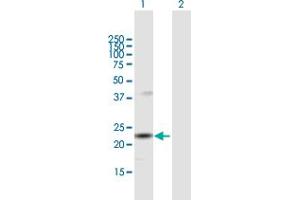 Western Blot analysis of SNX12 expression in transfected 293T cell line by SNX12 MaxPab polyclonal antibody. (SNX12 抗体  (AA 1-172))