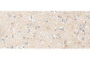 Immunohistochemistry of paraffin-embedded Human brain tissue using PNPO Polyclonal Antibody at dilution of 1:30(x200) (PNPO 抗体)