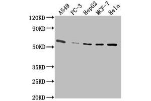 Western Blot Positive WB detected in: A549 whole cell lysate, PC-3 whole cell lysate, HepG2 whole cell lysate, MCF-7 whole cell lysate, Hela whole cell lysate All lanes: PD-L1 antibody at 1:2500 Secondary Goat polyclonal to Mouse IgG at 1/10000 dilution Predicted band size: 33 kDa Observed band size: 55 kDa