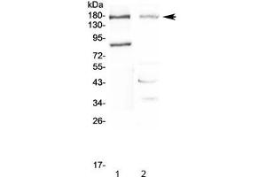Western blot testing of 1) rat pancreas and 2) mouse NIH 3T3 lysate with NPC1 antibody at 0.