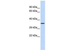 Image no. 1 for anti-Zinc Finger Protein 124 (ZNF124) (C-Term) antibody (ABIN6740539) (ZNF124 抗体  (C-Term))