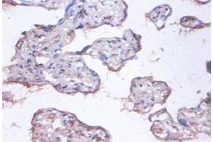 Immunohistochemistry of paraffin-embedded human placenta tissue using ABIN7148312 at dilution of 1:100 (COMMD4 抗体  (AA 1-195))