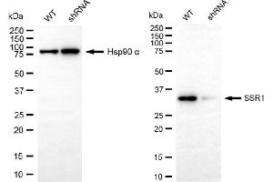 Western blotting analysis using SSR1 antibody (ABIN7800333). (Recombinant SSR1 抗体)