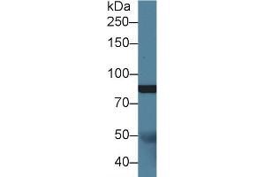 Detection of Slit1 in Porcine Cerebrum lysate using Polyclonal Antibody to Slit Homolog 1 (Slit1)
