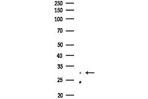 anti-CCAAT/enhancer Binding Protein (C/EBP), epsilon (CEBPE) (Internal Region) antibody