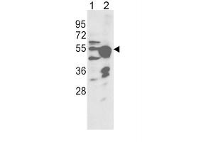 Western Blotting (WB) image for anti-Cytochrome P450, Family 2, Subfamily R, Polypeptide 1 (CYP2R1) antibody (ABIN3003559) (CYP2R1 抗体)