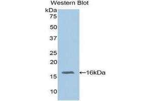 Western blot analysis of the recombinant protein. (RBP3 抗体  (AA 1027-1229))