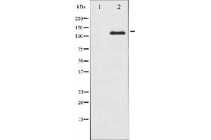 Western blot analysis of c-Kit expression in HeLa whole cell lysates,The lane on the left is treated with the antigen-specific peptide. (KIT 抗体  (Internal Region))