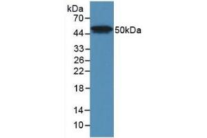 Detection of Recombinant LpPLA2, Human using Monoclonal Antibody to Phospholipase A2 Group VII (LpPLA2) (PLA2G7 抗体  (AA 22-441))