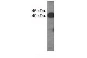 Western analysis of extracts from HDMEC cells using VEGFC antibody.