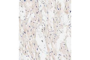 Immunohistochemistry (Paraffin-embedded Sections) (IHC (p)) image for anti-EH-Domain Containing 2 (EHD2) (AA 415-449), (C-Term) antibody (ABIN6243197)