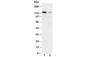 Western blot testing of Integrin alpha 3 antibody and Lane 1:  rat heart (ITGA3 抗体  (N-Term))