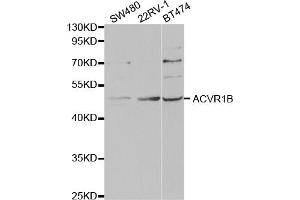 Western blot analysis of extracts of various cell lines, using ACVR1B antibody (ABIN5973168) at 1/1000 dilution. (Activin A Receptor Type IB/ALK-4 抗体)