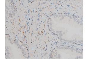 Immunohistochemistry (IHC) image for anti-GATA Binding Protein 1 (Globin Transcription Factor 1) (GATA1) (pSer142) antibody (ABIN6254982)