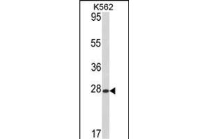 Western Blotting (WB) image for anti-ADP Ribosylation Factor Like GTPase 1 (ARL1) (AA 1-30), (N-Term) antibody (ABIN388997)
