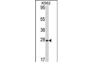 Western blot analysis of hARL1-G3 (ABIN388997 and ABIN2839227) in K562 cell line lysates (35 μg/lane). (ARL1 抗体  (N-Term))