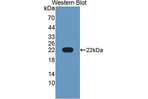 Detection of Recombinant CDKN2D, Human using Polyclonal Antibody to Cyclin Dependent Kinase Inhibitor 2D (CDKN2D) (CDKN2D 抗体  (AA 1-166))