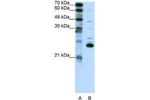 WB Suggested Anti-RCV1 Antibody Titration:  0.