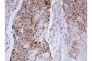 Image no. 2 for anti-Mitochondrial Translational Initiation Factor 3 (MTIF3) (AA 56-278) antibody (ABIN1491590) (MTIF3 抗体  (AA 56-278))