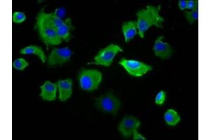 Immunofluorescence staining of MCF-7 cells with ABIN7169703 at 1:133, counter-stained with DAPI. (SIRPB1 抗体  (Isoform 3))